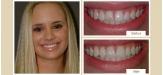 smile-gallery